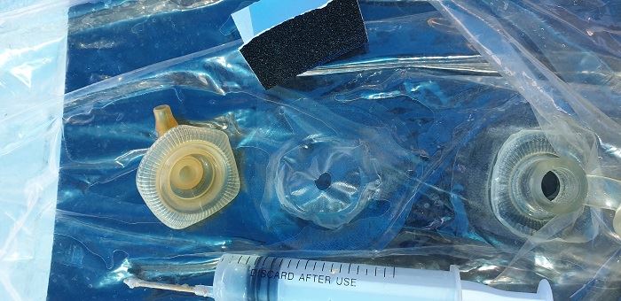 תיקון והחלפה של פיה של קייט שהשתחררה